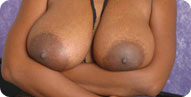 big black breasts